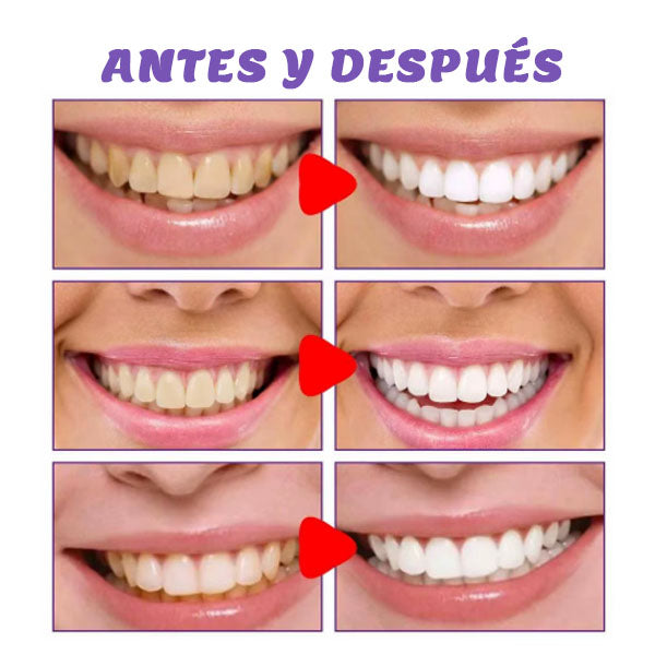 Crema Dental Blanqueadora Original – Limpieza y Frescura