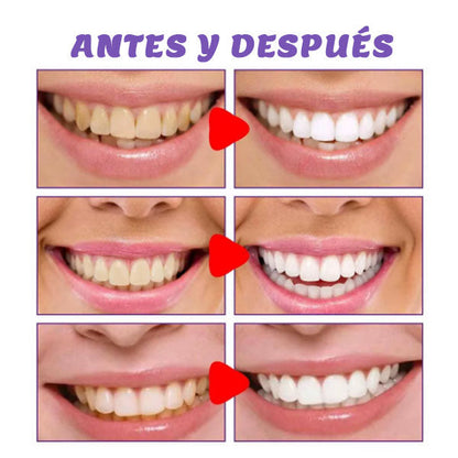 Crema Dental Blanqueadora Original – Limpieza y Frescura