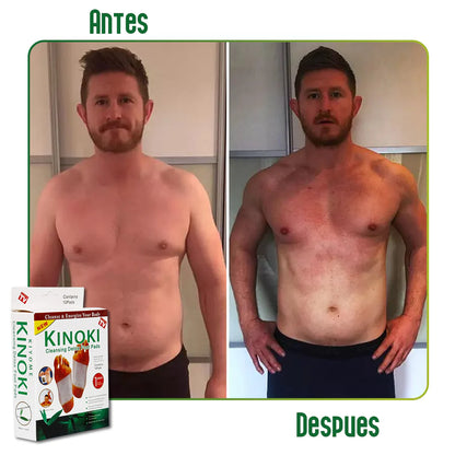 Desintox Parches de Detox Natural - Elimina Toxinas y Acelera el Metabolismo