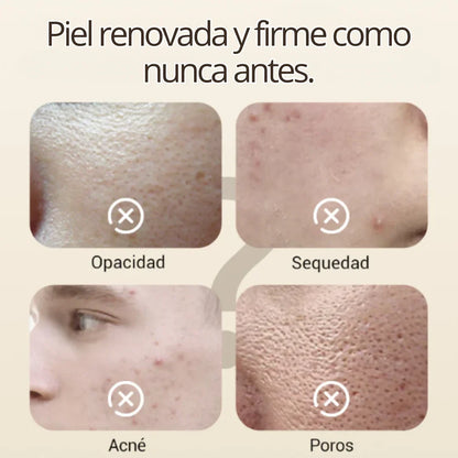 Hidratación, Claridad y Renovación con ClariSkin 75g – Tu Piel Más Joven y Uniforme. [Uso nocturno]